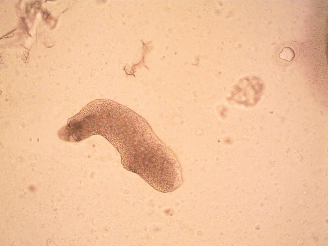 Hewan Amoeba. [Pexels]